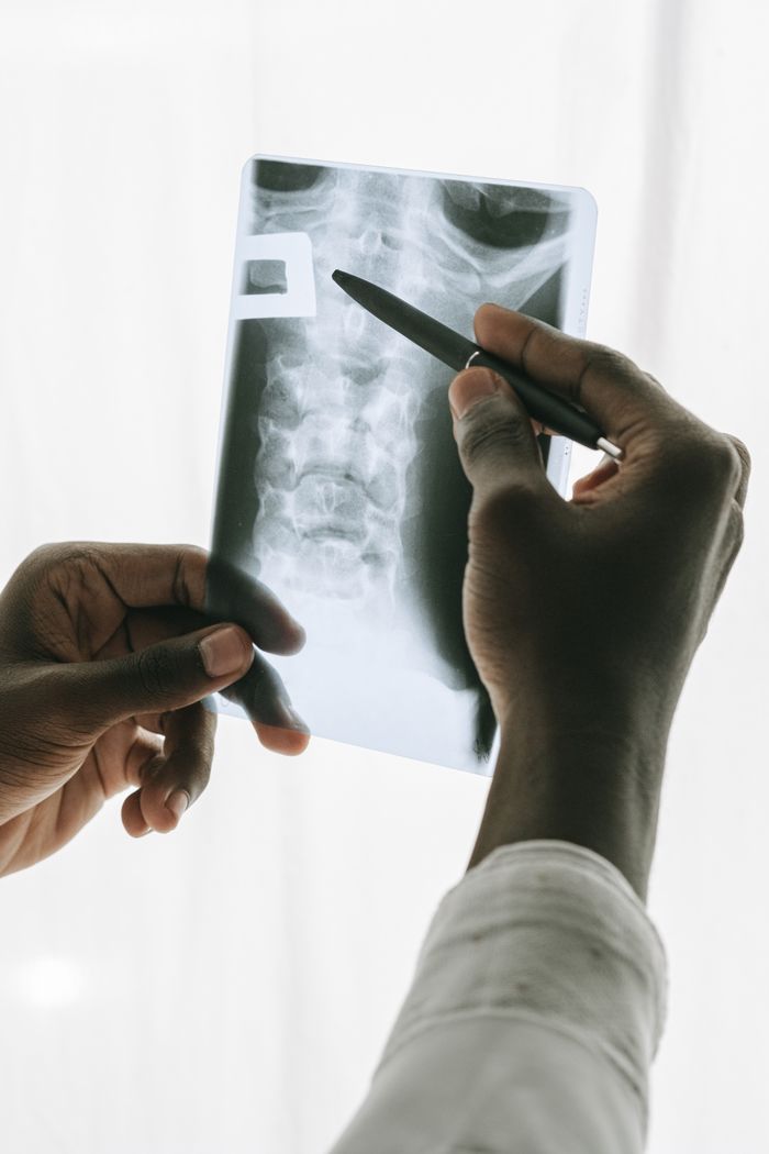 Home A radiologist examines an x-ray of a thorax, highlighting medical analysis.